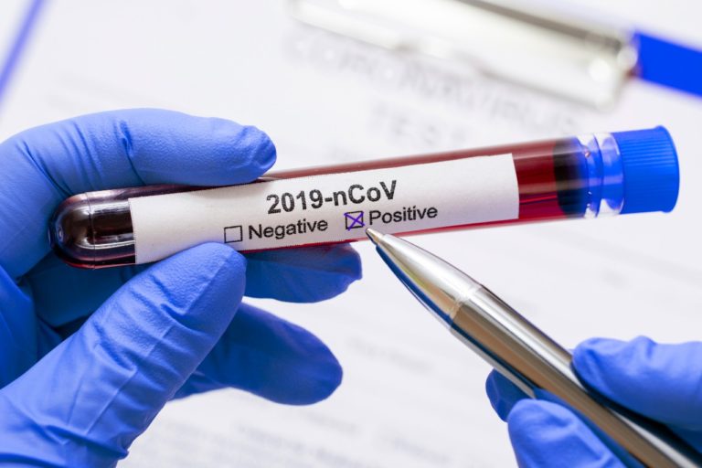 1.582 Orang Rapid Test di Depok, 65 Diantaranya Positif Corona