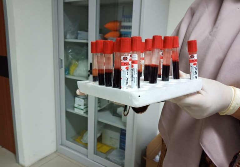 Pemprov DKI Terapkan Rapid Test COVID-19 Pakai Serum